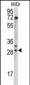 MRPL9 Antibody (N-term)